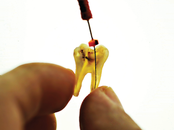 Pac-Dent - Front Page - Press Release - JS Dental - 01