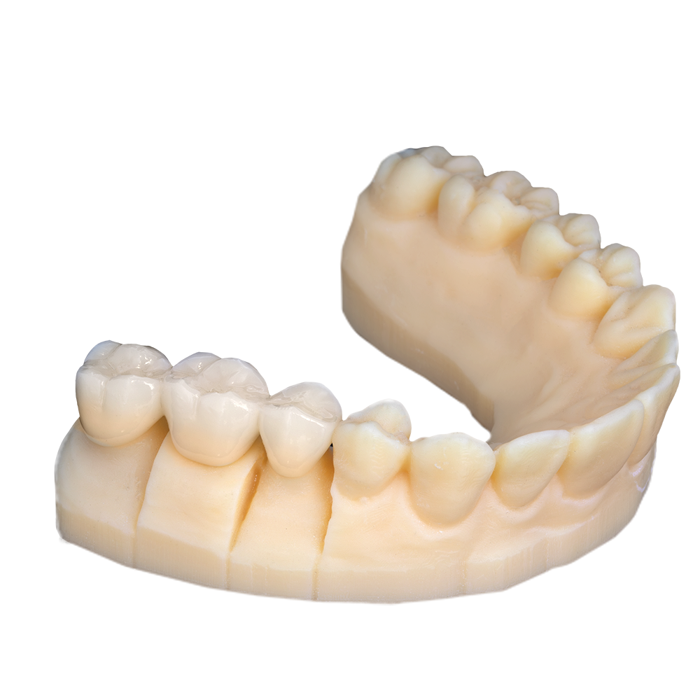 Rodin® RapidCeram Ceramic Nanohybrid Resin - Image 2